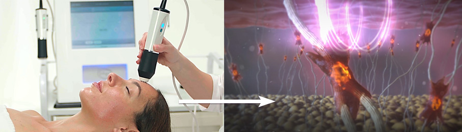 دستگاه پلاژن سه هندپیس